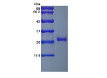 Recombinant Human soluble Tumor Necrosis Factor Receptor Type II/TNFRSF1B