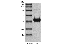 Recombinant Human Fibroblast Growth Factor 19