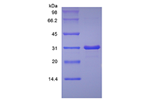 Recombinant Human Insulin-like Growth Factor-Binding Protein 7