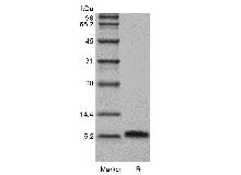 Recombinant Human Beta-defensin 5