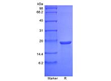 Recombinant Murine Mesencephalic Astrocyte-Derived Neurotrophic Factor