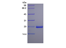 Recombinant Rat Leukemia Inhibitory Factor