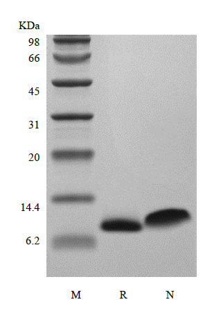 Recombinant Human Regulation upon Activation Normal T cell Express Sequence/CCL5