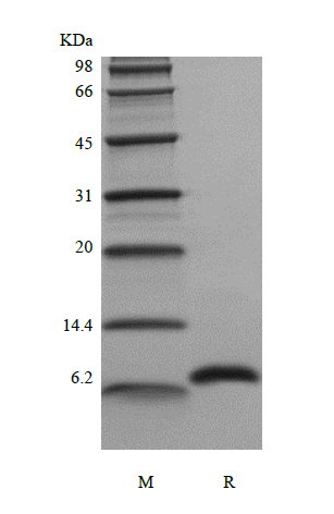 Recombinant Human Hemofiltrate CC Chemokine-1, 66a.a./CCL14