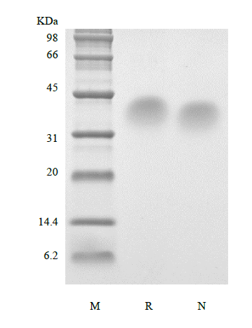 Recombinant Human Parathyroid Hormone 53-84