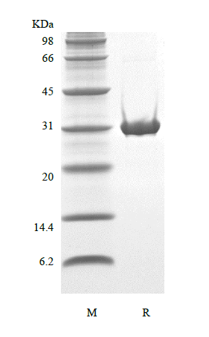 Recombinant Human TP53-induced Glycolysis and Apoptosis Regulator-TAT