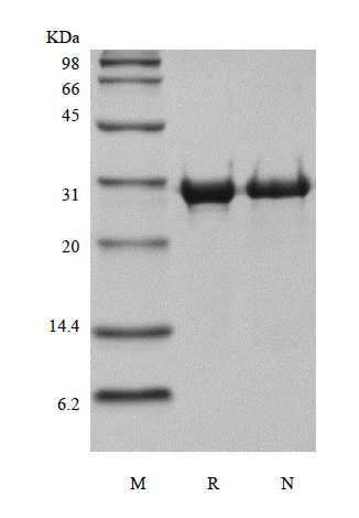 Recombinant Human Matrix metalloproteinase-14