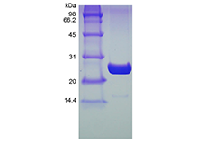 Recombinant Human Ubiquitin-conjugating Enzyme E2 K, His