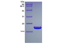 Recombinant Human Ubiquitin-conjugating Enzyme E2 B, His