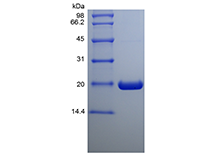 Recombinant Human Ubiquitin-conjugating Enzyme E2 C, His