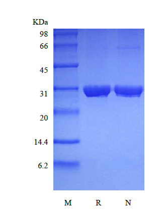 Recombinant Human Ubiquitin-conjugating Enzyme E2 R1