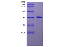 Recombinant Human High Mobility Group Box-1 Protein, His