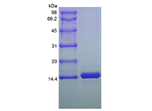 Recombinant Human Melanoma Inhibitor Activity Protein 2