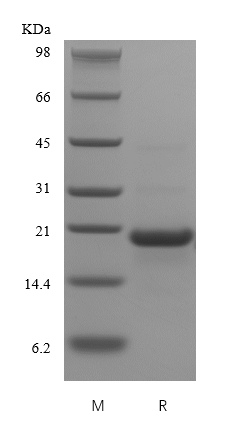 Recombinant Human soluble CD23