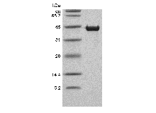 Recombinant Human Cardiac muscle troponin T