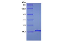 Recombinant Human Fatty-acid-binding Protein 2