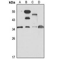 Anti-WDR61 Antibody