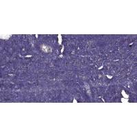 Versican Polyclonal Antibody