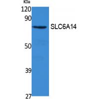 SLC6A14 Polyclonal Antibody