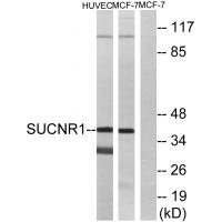 GPR91 Polyclonal Antibody