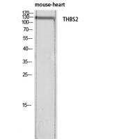 Thrombospondin 2 Polyclonal Antibody