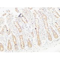 Thrombospondin 2 Polyclonal Antibody