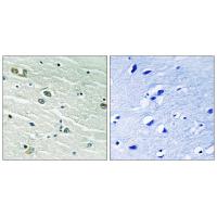 MerTK/Tyro3 Polyclonal Antibody