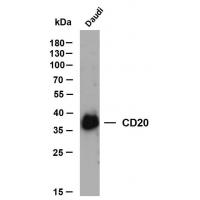 CD20 mouse mAb