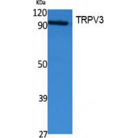 TRPV3 Polyclonal Antibody