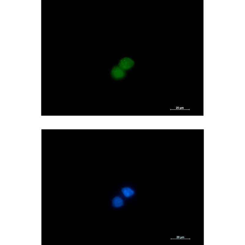 MSP Rabbit mAb