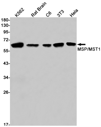 MSP Rabbit mAb