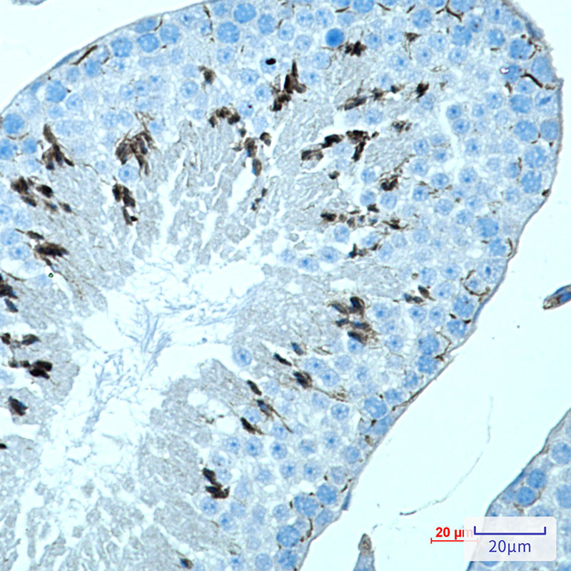 MAGEC2 Rabbit mAb