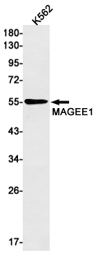 MAGEC2 Rabbit mAb