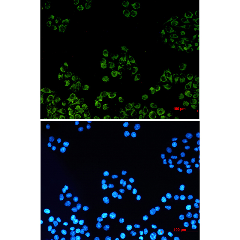 PBR Rabbit mAb