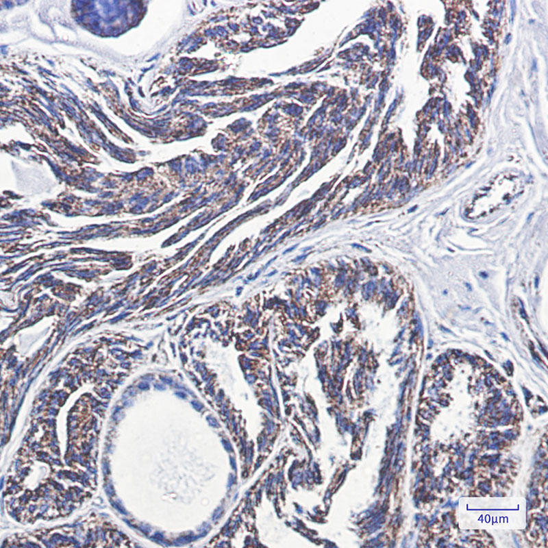 PBR Rabbit mAb