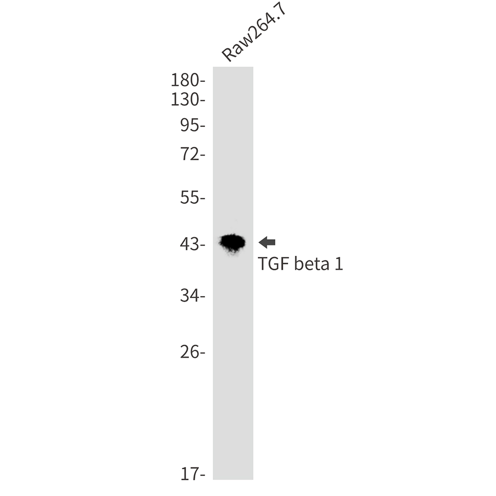 TGF beta 1 Rabbit mAb