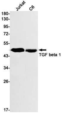 TGF beta 1 Rabbit mAb