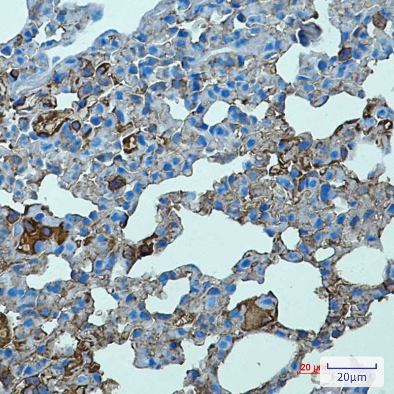 Toll-Like Receptor 2 Rabbit mAb