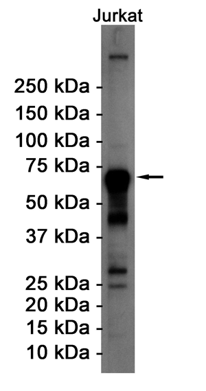 ATF2 Rabbit mAb