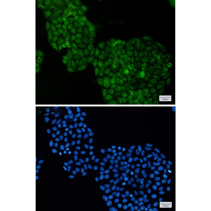 ADRM1 Rabbit mAb