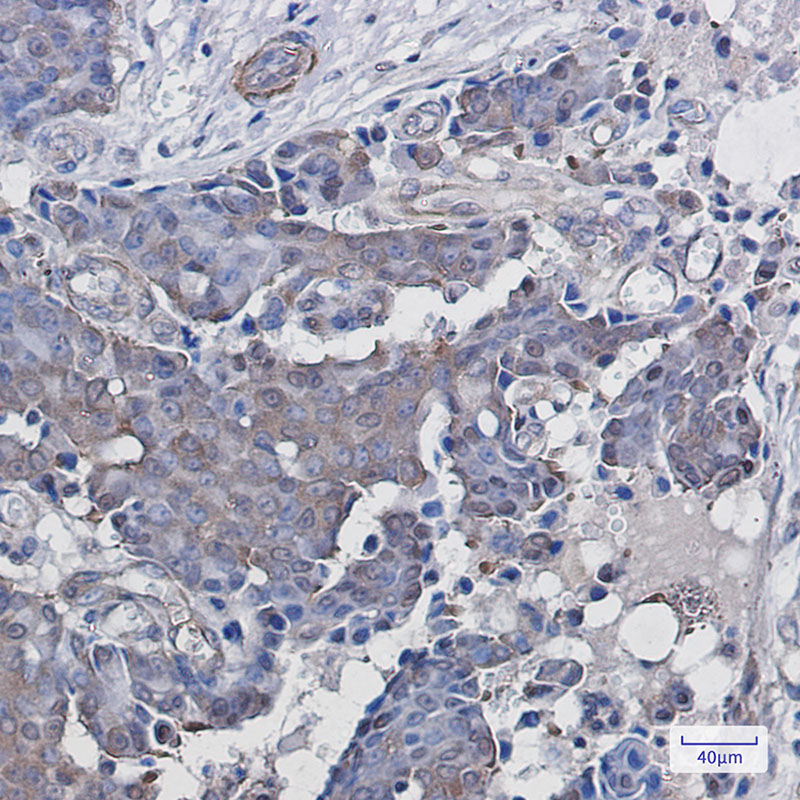 ADRM1 Rabbit mAb