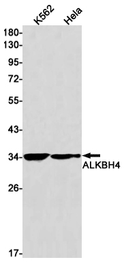 ALKBH4 Rabbit mAb