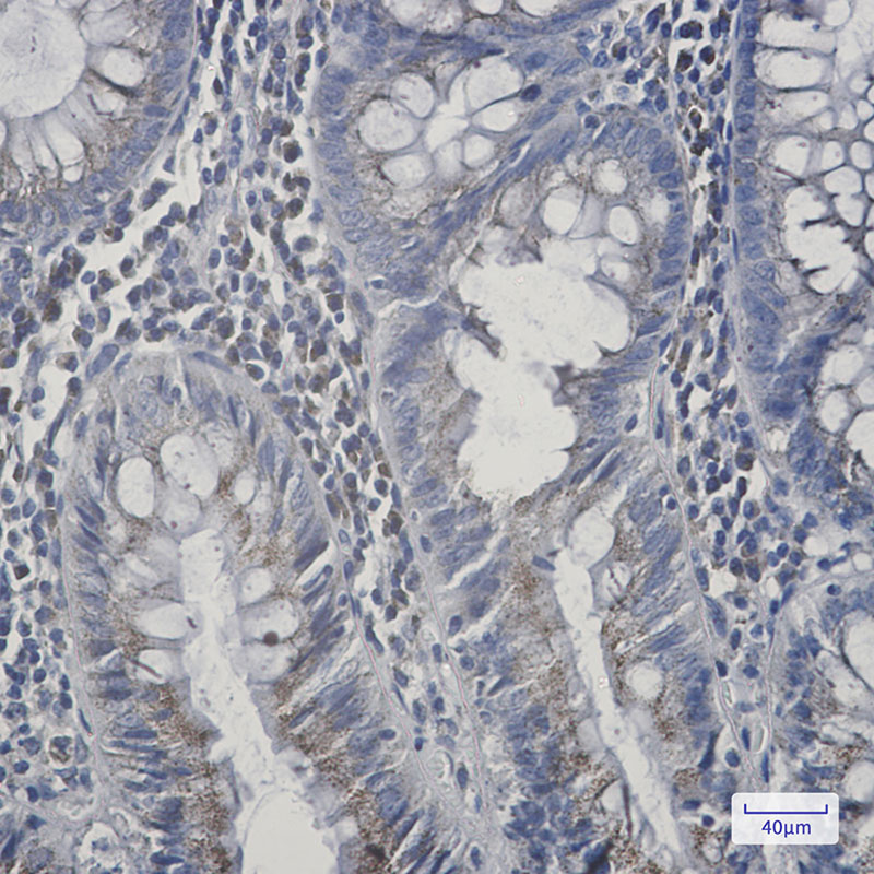 AGPS Rabbit mAb