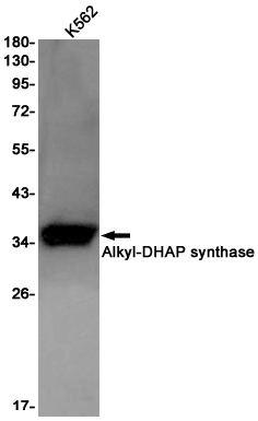 AGPS Rabbit mAb