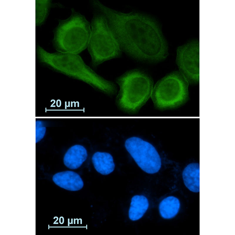 Annexin A1 Rabbit mAb