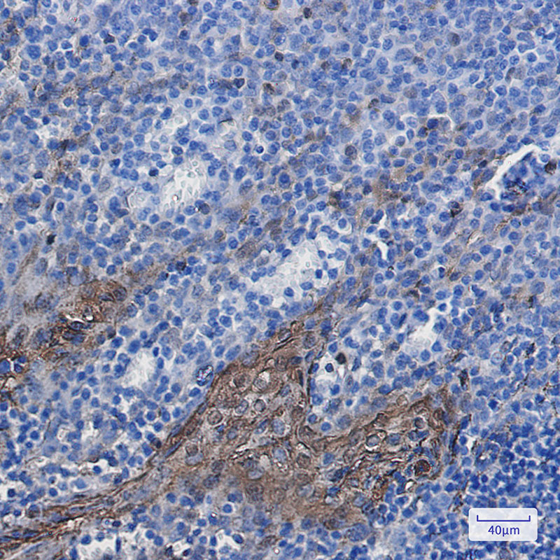 Annexin A1 Rabbit mAb