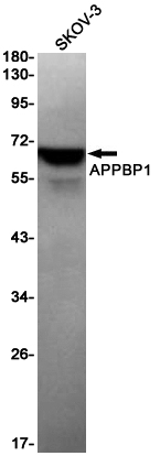 APPBP1 Rabbit mAb