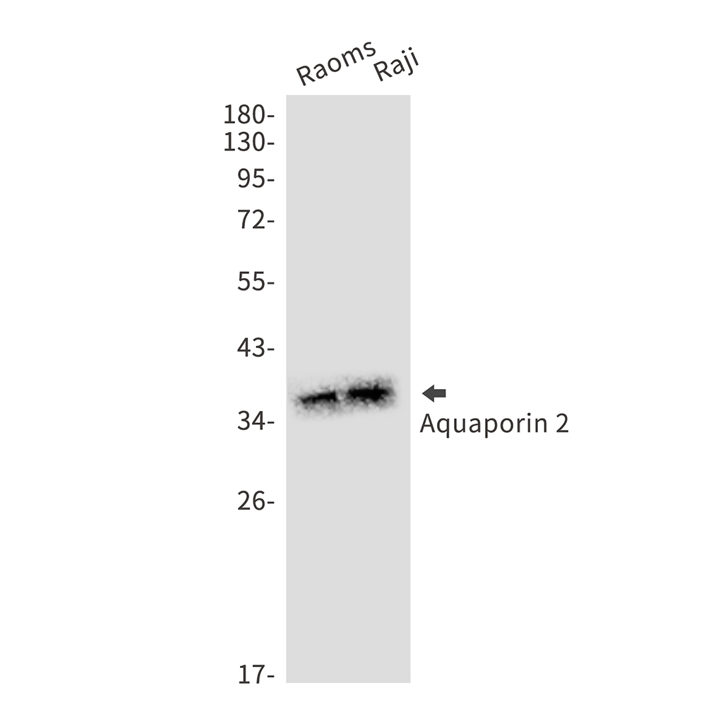 Aquaporin 2 Rabbit mAb