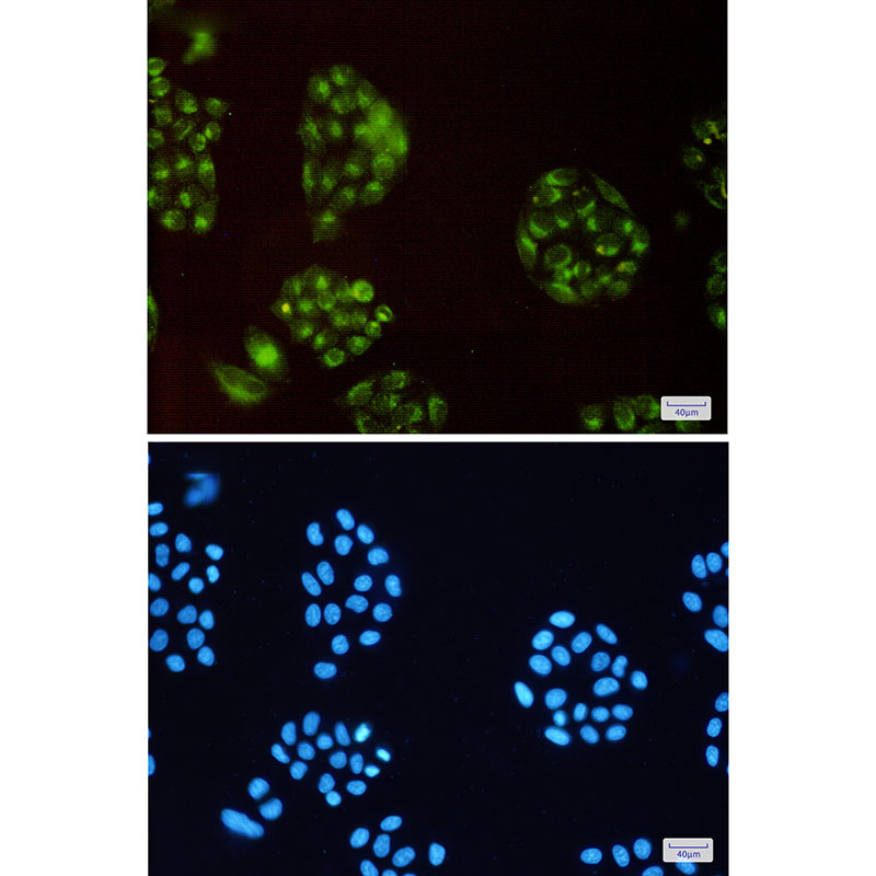 ATP6V0D1 Rabbit mAb