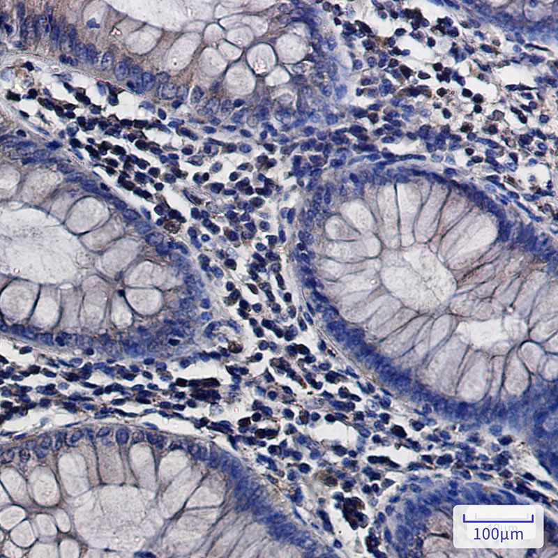 ATP6V0D1 Rabbit mAb